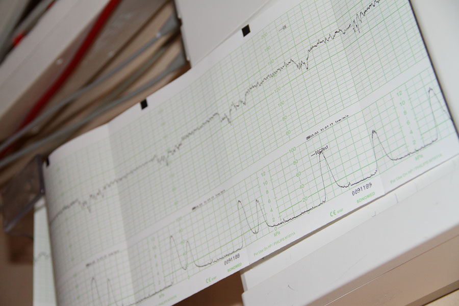 Sharon's contraction and baby heart monitors